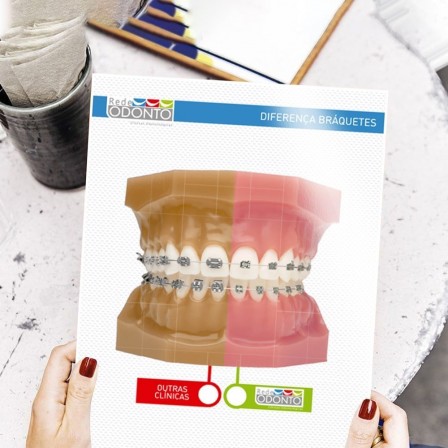 Lâminas Braquetes para dentistas